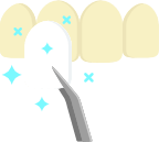 icon of four yellow teeth with 4 white veneers being held up to it indicating veneers can fix tooth discoloration