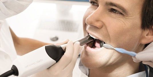 Adult male in a dental chair with a 3D scanner placed in his mouth. They are scanning the area of the tooth that needs a crown.